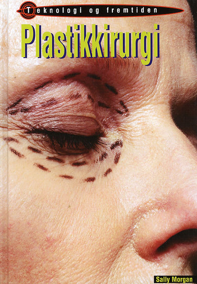Plastikkirurgi
