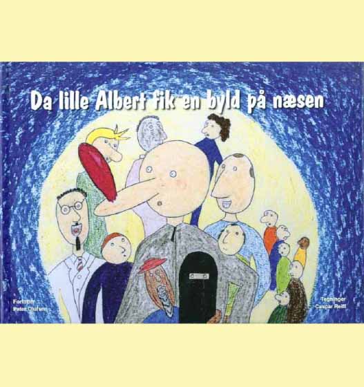 Da lille Albert fik en byld på næsen